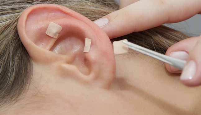 reflexologia auricular